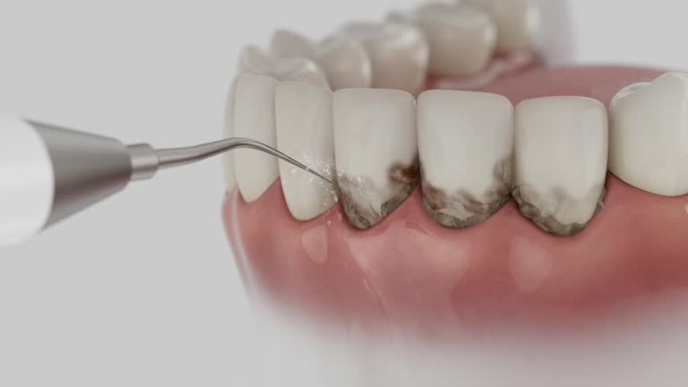 Trusted Emergency Dentist service in Ellettsville, IN - Dentist Open Now